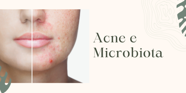 Acne e Microbiota